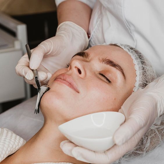 Benefits of a Chemical Peel
